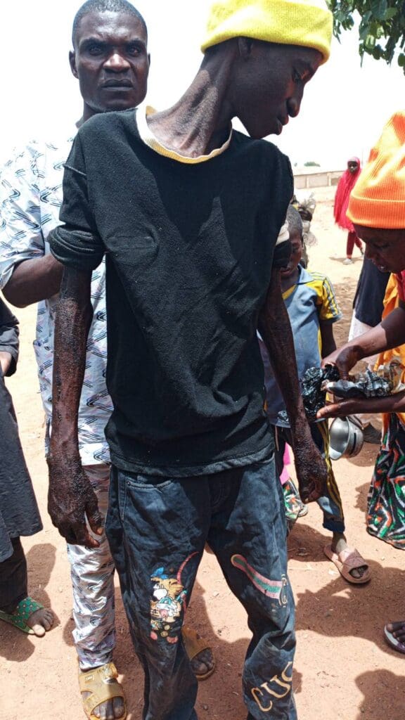David Maza, a recently released victim from Rijana Camp.