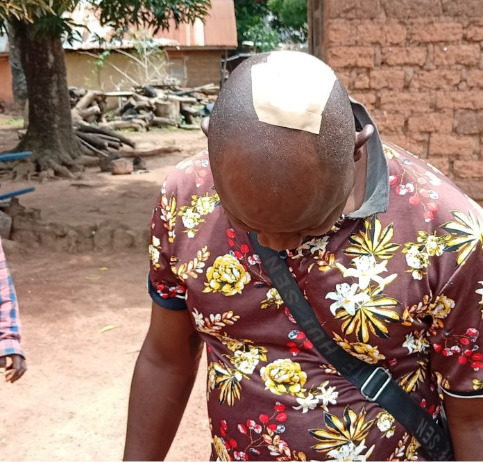 Alapa Adah, in the red shirt, is a villager wounded by Fulani terrorists. Photo by Mike Odeh James. Credit Mike Odeh James.