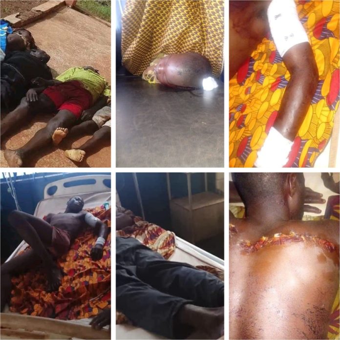 Victims of Abaushwa night attack Credit: Guma County Archive
